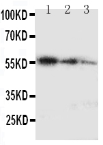 WB - Anti-Ki67 Antibody ABO11221